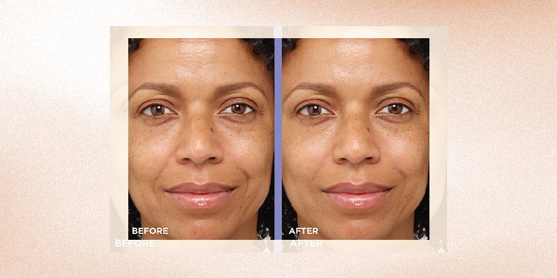 BMAG InArticleImagery Hyaluronic Acid Ceramides Water Cream